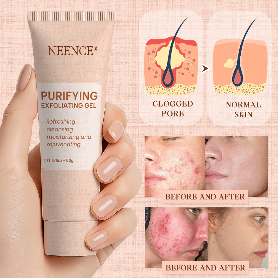 NEENCE® 🔥Purifying Exfoliating Gel for Acanthosis Nigricans, Exfoliation, Dark Spots, Skin Tags, and Eczema_Ultra01