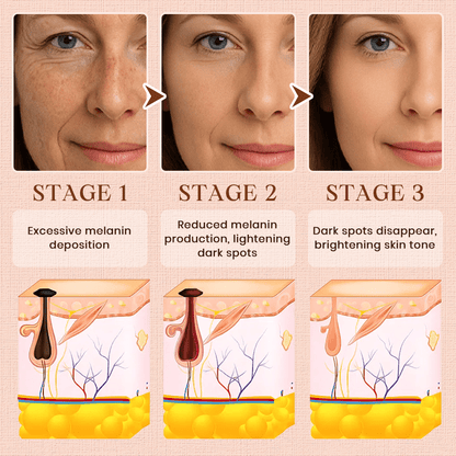 NEENCE® 🔥Purifying Exfoliating Gel for Acanthosis Nigricans, Exfoliation, Dark Spots, Skin Tags, and Eczema_Ultra01