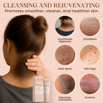 NEENCE® 🔥Purifying Exfoliating Gel for Acanthosis Nigricans, Exfoliation, Dark Spots, Skin Tags, and Eczema_Ultra01