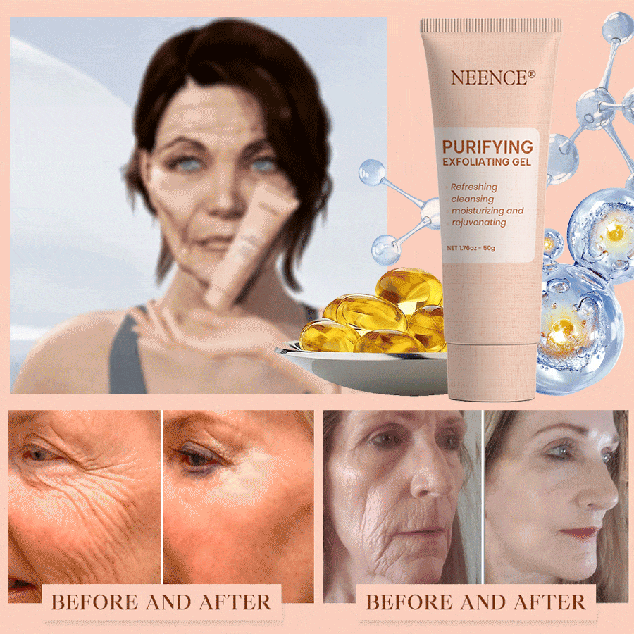 NEENCE® 🔥Purifying Exfoliating Gel for Acanthosis Nigricans, Exfoliation, Dark Spots, Skin Tags, and Eczema_Ultra01