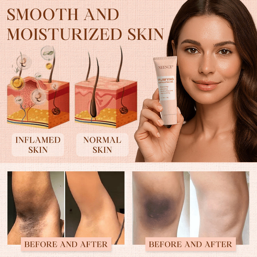NEENCE® 🔥Purifying Exfoliating Gel for Acanthosis Nigricans, Exfoliation, Dark Spots, Skin Tags, and Eczema_Ultra01