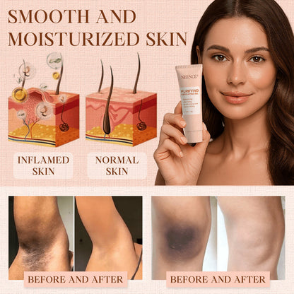 NEENCE® 🔥Purifying Exfoliating Gel for Acanthosis Nigricans, Exfoliation, Dark Spots, Skin Tags, and Eczema_Ultra01